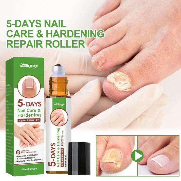 South Moon 5-day nail repair roller repairs onychomycosis, soft nails, bright nails, thickening nail care liquid