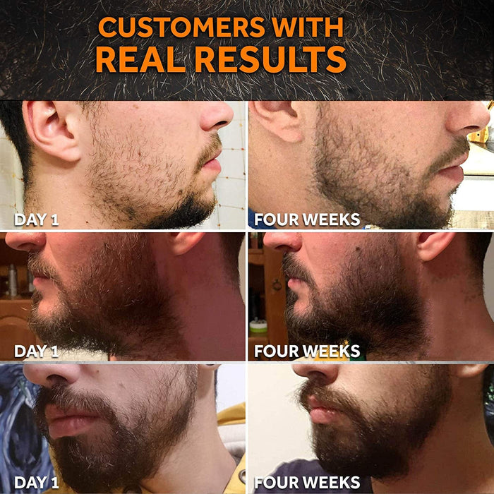 Cross-border new products men's beard care kit beard liquid cleaning nutrition care beard kit from stock